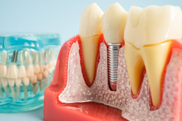 Best Cosmetic Dentistry  in USA